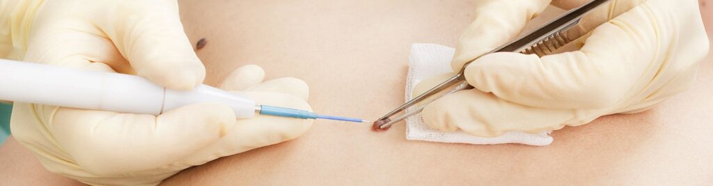 minorsurgery