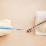 minorsurgery