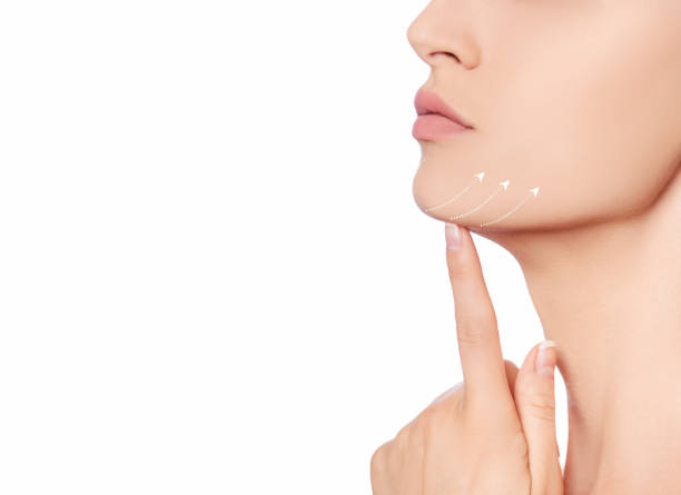 Double chin removal in Jeddah