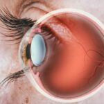 eye test at home