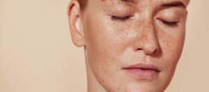Pigmentation Treatment in Dubai: What to Expect During Your First Session
