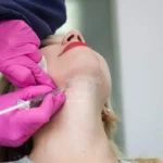 kybella san ramon