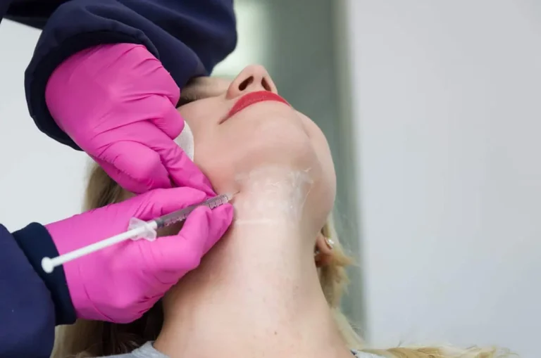 kybella san ramon