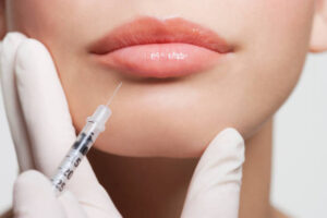 Are Lip Filler Injections Suitable for Younger Adults