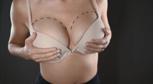 Breast-augmentation-risks