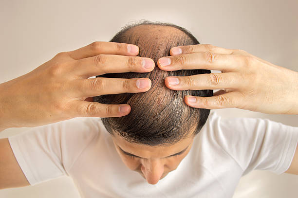 Can GFC Treatment for Hair help with genetic hair loss