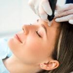 Does Microneedling Help With Uneven Facial Skin Tone