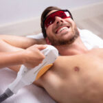 How Long Is a Men’s Laser Hair Removal Session
