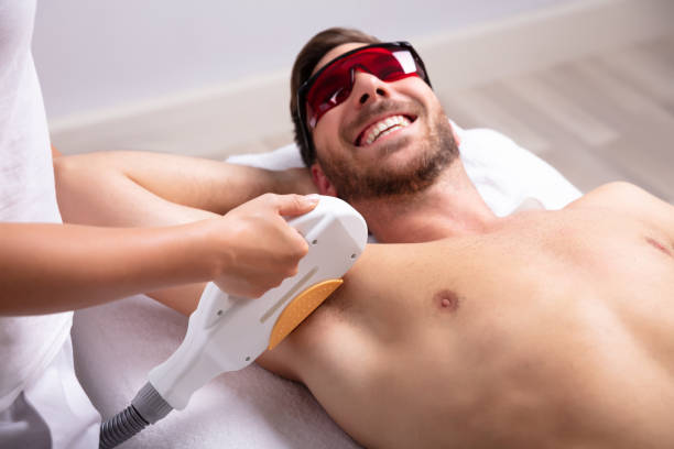 How Long Is a Men’s Laser Hair Removal Session