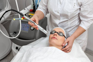 How Many Pico Laser Treatment Sessions Do You Need