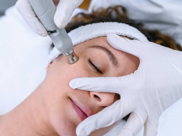 Is CO2 Laser Treatment Safe Around Your Sensitive Eyes