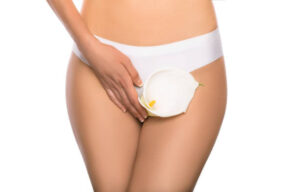 Is Intimate Area Contouring a Permanent Solution