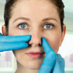 Is Rhinoplasty Effective for Nose Asymmetry