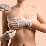 Mia Breast Implant In Dubai