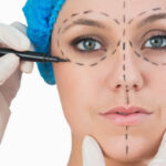 What should you ask before choosing Facelifts surgery