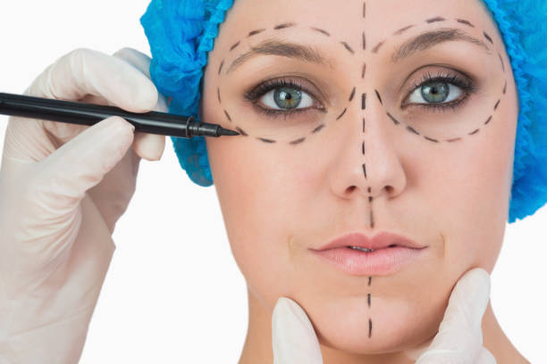 What should you ask before choosing Facelifts surgery