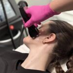 RF facial contouring Alberta