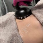 body contouring treatment Edmonton
