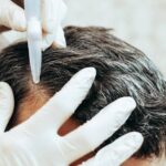 hair fall treatment in Dubai