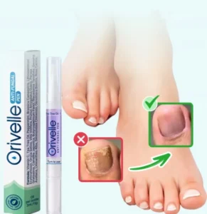 Orivelle fungus treatment