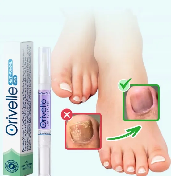 Orivelle fungus treatment