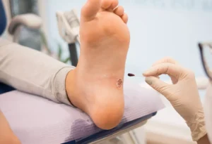 Wound care services in Troy, Michigan